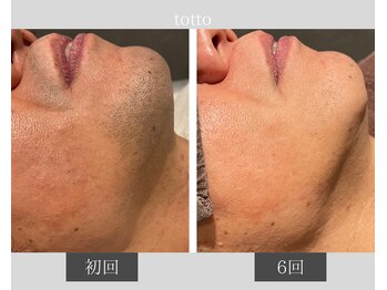 サロントット(salon totto)/before→after