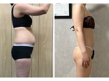 スリーピングビューティー(Sleeping Beauty)/