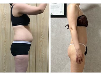 スリーピングビューティー(Sleeping Beauty)/