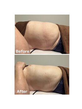 ボディケアアップ(BODY CARE UP↑)/WINBACKお腹集中　２回目の変化