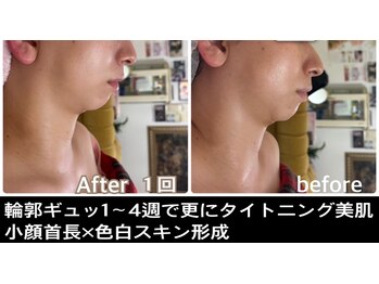 アルページュ(Arpege)/美女達に人気急増♪チタニウム