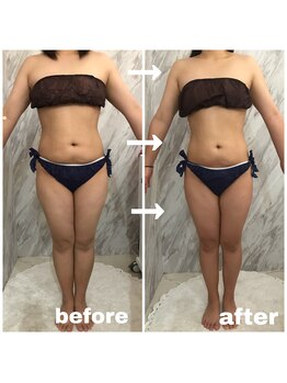 ラニ(LANI)/新型ハイパーナイフ6