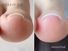 ダイヤモンドボディ/