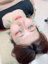 ヒーリングサロン アージュ(A-je)/★美顔鍼＋小顔矯正★