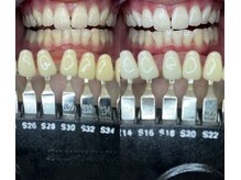 トウキョウスワーズ 池袋店(TOKYO SWRS)/#ホワイトニング #池袋 #渋谷