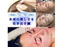 フェリース鍼灸院