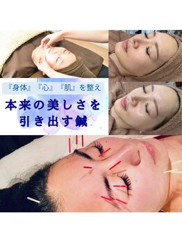 フェリース鍼灸院の写真/【話題★ハリウッドスタイル上田式美容鍼】鍼が苦手&初心者でも◎少ない針で効率良く、キュッと引き上げる!