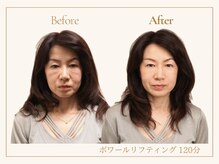 シルクフェイス 桜新町(Silk face)の雰囲気（年齢肌に特化！エイジングケア！ボワールリフティング）