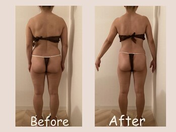 レモン(Lemon)/ビフォーアフター