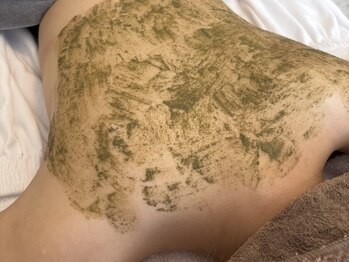 ソアの写真/【花嫁様にも大人気！】もう隠さない自信の持てる美背中を"海洋性ハーブピーリング"で実現◎