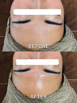 ルーク(Luke)/くすみケア