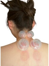 ロサ ケンティフォリア(Rosa centifolia)/特殊なシリコンカッピング