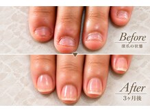 ミリアネイル 成城(Miliea nail)の雰囲気（深爪育成３ヶ月集中コース！３ヶ月でここまで変わる！）
