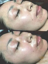 オレアグリーン 岡崎(OLEA green)/before after(ブライダル)