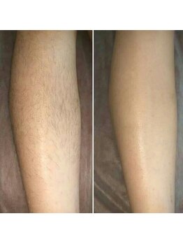 ヴィテラス バイ アリア(Veteras by aria)/☆どんな毛質にも対応☆