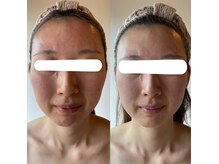 エステティックサロン ドゥネールの雰囲気（技術に自信あり☆最高のトリートメントを提供します！）