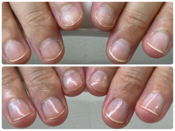 ラ ルアナ(La Luana)/ハンドケア◇ビフォーアフター