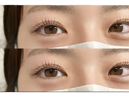 ルメル(Lumer)の写真