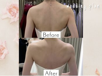 エステティックサロン アールグレー/フォトwedding＆挙式に向けて