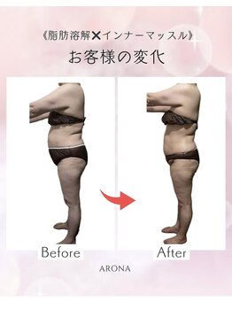 アローナ(ARONA)/ダイエット諦めずに済みます！