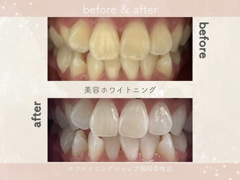 ホワイトニングショップ 福岡香椎店/美容ホワイトニングサロン