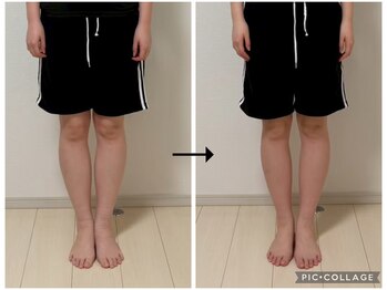 ソリ(soli)/before→after写真