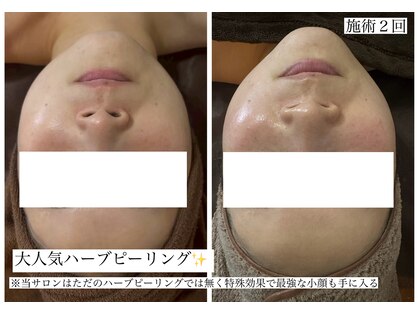 ヴィズクラブ バイ ビネル(Vi's CLUB by BINEL)の写真