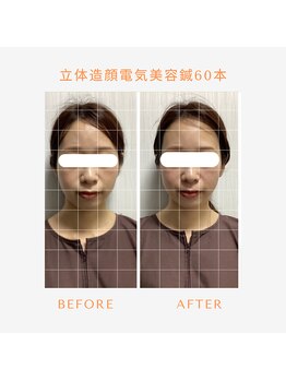 サロン ド ハリッシュ(Salon de HARISH)/即効性も◎