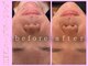 【ハーブピーリング/毛穴洗浄/小顔リフト】total beauty salon mayahime 大宮店の写真
