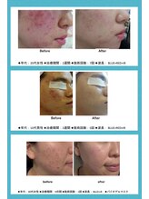 アンジェリック ビーナス(Angelic Venus)/