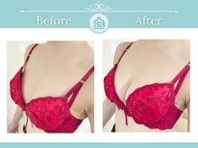 美人バスト 浜松店/◇ バストアップ &nbsp;BeforeAfter◇