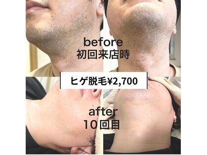 トータルビューティー マカシー(TotalBeauty makasih)の写真