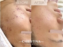 サロンブランシュ(salon BLANCHE)/短期集中ケアでお悩みの解決◎