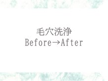 ブリリアン デイスパ 阪急西宮ガーデンズ店(BRILLIAN DAYSPA)/毛穴洗浄