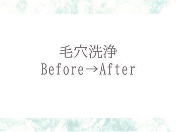 ブリリアン デイスパ 阪急西宮ガーデンズ店(BRILLIAN DAYSPA)/毛穴洗浄