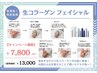 【シミしわ、赤ら顔、ニキビ肌】IPL光施術 ¥13,000→¥7,800