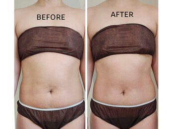 ラプタス(Rapu+)/浮き輪肉とポッコリお腹に喝