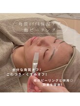 ソワン(soin)/◆酸ピーリング/最短月1回ペース