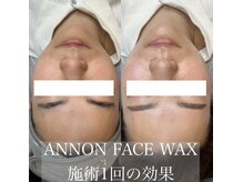 ルファナ(Lufana)/【艶肌】フェイシャルワックス