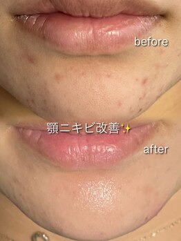 リイル バイ クレビア(REILE by Crebia)/お客様写真