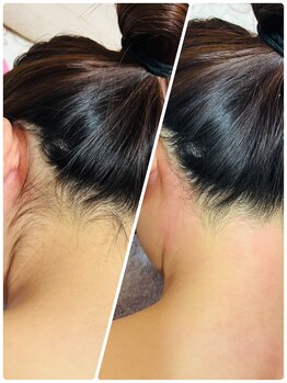 シュガーリングハウス ベル(Bell)/うなじ・背中シュガーリング