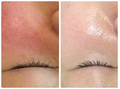 グランヴェルジェ(Granverger)の写真