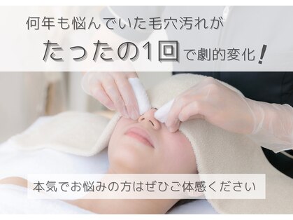 スピカ(spica)の写真