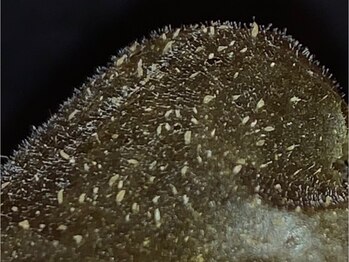 ブライダルベールトータルビューティ(BRIDAL VEIL total beauty)/剥離しないハーブピーリング