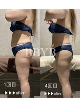 ビーバイビー(BBYB)/ぽっこりお腹！！