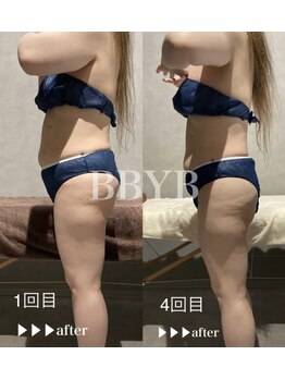 ビーバイビー(BBYB)/ぽっこりお腹!!