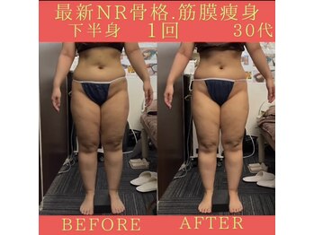 リラクゼーションサロン ラキ(laki)/NR筋膜骨格調整1回