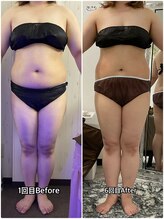 輝 らいと/ビフォーアフター（正面）