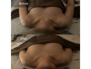 ハートランド(HEARTLAND)/おためしでも効果はしっかり