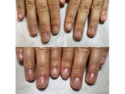 ルースネイル(Loose Nail)の写真